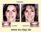 Urlaub Zahnbehandlung - 1 Woche Euro 299 all inclusive