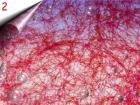 Laser Lace - Nagel Netz um 2 40Euro